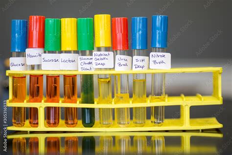 test biochimie|biochemical testing.